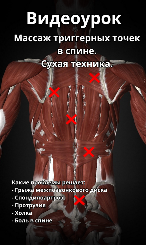 [Артем Пак] Массаж триггерных точек в спине (2024)_0.png